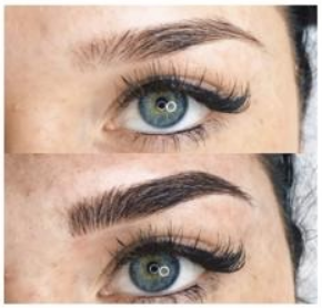 MicroPigmentación Pelo a Pelo