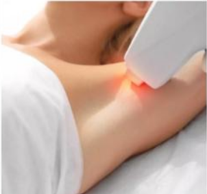 Depilación láser Axilas