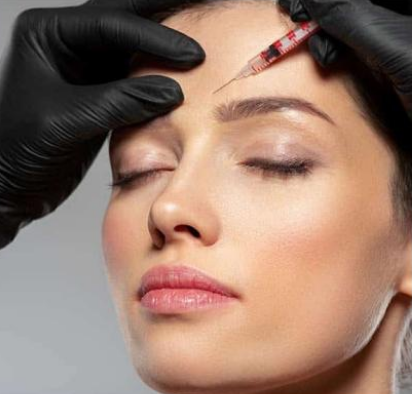 Perfilación con acido hialurónico